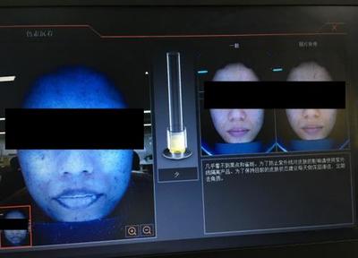 皮膚檢測儀深度實測 Visia、美圖宜膚、A-one究竟哪家強？